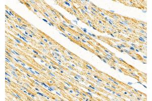 ABIN6265960 and ABIN6273343 at 1/100 staining Rat heart tissue by IHC-P.