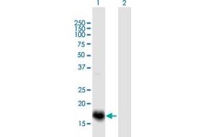 Western Blot analysis of ESM1 expression in transfected 293T cell line by ESM1 MaxPab polyclonal antibody. (ESM1 抗体  (AA 1-184))