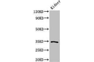 Western Blot Positive WB detected in: Mouse kidney tissue All lanes: KLF7 antibody at 3 μg/mL Secondary Goat polyclonal to rabbit IgG at 1/50000 dilution Predicted band size: 34, 30, 25, 31, 14, 10 kDa Observed band size: 34 kDa (KLF7 抗体  (AA 114-220))