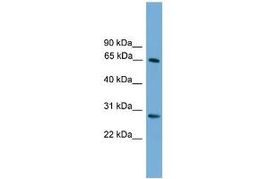 WB Suggested Anti-FBXW8 Antibody Titration: 0. (FBXW8 抗体  (Middle Region))