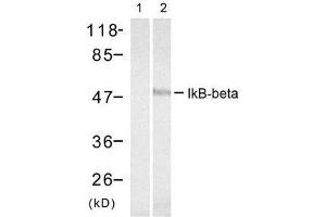 Western blot analysis of extract from 293 cells treated with TNF-α, using IκB-β (Ab-23) antibody (E021304, Lane 1 and 2). (NFKBIB 抗体)