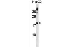 Western Blotting (WB) image for anti-Lipoma HMGIC Fusion Partner (LHFP) antibody (ABIN2999873) (LHFP 抗体)
