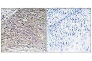 Immunohistochemistry analysis of paraffin-embedded human testis tissue using MAST4 antibody. (MAST4 抗体)