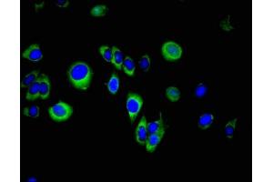 Immunofluorescence (IF) image for anti-serine Peptidase Inhibitor, Kunitz Type, 2 (SPINT2) (AA 71-194) antibody (ABIN7157739)