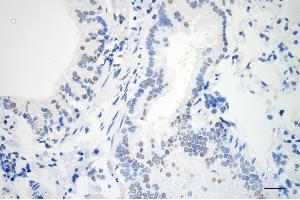 Immunohistochemistry was performed on paraffin-embedded mouse lung using AKAP8 antibody (ABIN7797435), 1:200). (AKAP8 抗体)