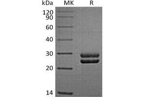 Western Blotting (WB) image for Prolactin (PRL) protein (His tag) (ABIN7321021) (Prolactin Protein (PRL) (His tag))