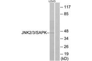 Western blot analysis of extracts from LOVO cells, using SAPK/JNK (Ab-183) Antibody. (SAPK, JNK (AA 166-215) 抗体)