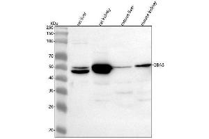 Western blot analysis of GBA3 using anti-GBA3 antibody (ABIN7600270).