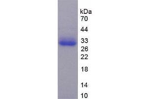 SDS-PAGE analysis of Human TRADD Protein. (TRADD 蛋白)