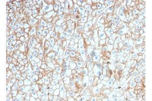 ABIN6383847 to PD-L1 was successfully used to stain membranes of carcinomas in human lung, cervex and breast sections. (PD-L1 抗体  (Extracellular Domain))