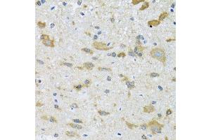Immunohistochemistry of paraffin-embedded mouse spinal cord using CCT4 antibody. (CCT4 抗体  (AA 130-390))