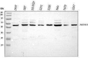 Western blot analysis of NOX4 using anti-NOX4 antibody (ABIN5692899). (NADPH Oxidase 4 抗体)