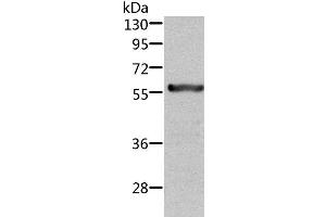Western Blot analysis of Rat kidney tissue using ALDH6A1 Polyclonal Antibody at dilution of 1:450 (ALDH6A1 抗体)