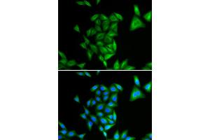 Immunofluorescence analysis of U2OS cells using PHYH antibody (ABIN5973726). (PHYH 抗体)