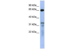RAP1GAP antibody used at 1 ug/ml to detect target protein. (RAP1GAP 抗体  (Middle Region))