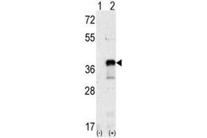 Image no. 2 for anti-SNAIL (SNAI1) (N-Term) antibody (ABIN357453) (SNAIL 抗体  (N-Term))