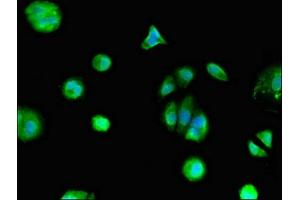 Immunofluorescent analysis of MCF-7 cells using ABIN7153311 at dilution of 1:100 and Alexa Fluor 488-congugated AffiniPure Goat Anti-Rabbit IgG(H+L) (Mesothelin 抗体  (AA 1-62))