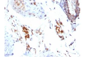 Immunohistochemistry (IHC) image for anti-Ferritin, Light Polypeptide (FTL) (AA 38-165) antibody (ABIN6939458)