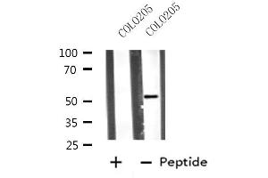 Western blot analysis of extracts from COLO205 cells, using VRK3 antibody. (VRK3 抗体  (Internal Region))