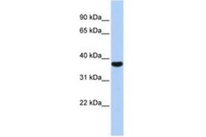 Image no. 1 for anti-Exosome Component 2 (EXOSC2) (AA 143-192) antibody (ABIN6740694) (EXOSC2 抗体  (AA 143-192))