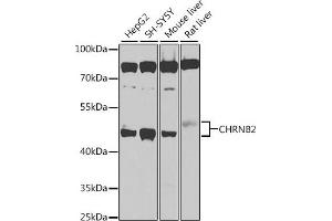 Western blot analysis of extracts of various cell lines, using CHRNB2 antibody (ABIN6131327, ABIN6138590, ABIN6138592 and ABIN6225110) at 1:1000 dilution. (CHRNB2 抗体  (AA 340-430))