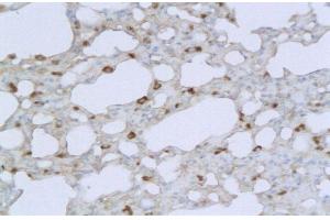 Formalin-fixed and paraffin embedded mouse lung labeled with Anti TMPRSS2 Polyclonal Antibody, Unconjugated  followed by conjugation to the secondary antibody and DAB staining (TMPRSS2 抗体  (AA 301-400))