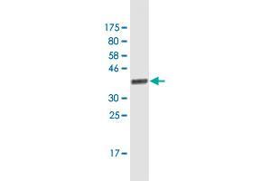 Western Blot detection against Immunogen (37. (EZH2 抗体  (AA 1-110))
