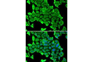Immunofluorescence (IF) image for anti-Myosin Heavy Chain 1, Skeletal Muscle, Adult (MYH1) (AA 1-100) antibody (ABIN6144230)