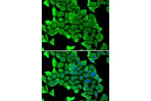 Immunofluorescence analysis of U2OS cells using MYH1 antibody. (MYH1 抗体  (AA 1-100))