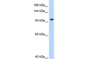 Western Blotting (WB) image for anti-Splicing Factor 3a, Subunit 1 (SF3A1) antibody (ABIN2462195) (SF3A1 抗体)