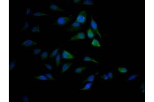 Immunofluorescence staining of Hela Cells with ABIN7127802 at 1:50, counter-stained with DAPI. (Recombinant SAE1 抗体)