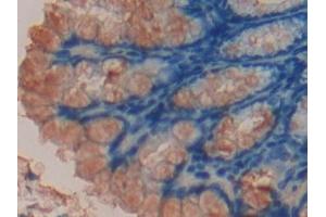 Detection of CCND2 in Mouse Intestine Tissue using Polyclonal Antibody to Cyclin D2 (CCND2) (Cyclin D2 抗体  (AA 47-267))