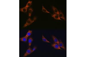 Immunofluorescence analysis of NIH-3T3 cells using γ-Catenin Rabbit mAb (ABIN1683043, ABIN3018625, ABIN3018626 and ABIN7101634) at dilution of 1:100 (40x lens).