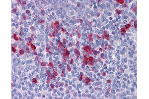 Anti-APPL1 antibody IHC of human tonsil.