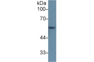 Western Blot; Sample: Rat Skin lysate; Primary Ab: 1µg/ml Rabbit Anti-Human KRT6A Antibody Second Ab: 0. (KRT6A 抗体  (AA 163-468))