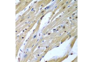 Immunohistochemistry of paraffin-embedded mouse heart using TUSC2 antibody at dilution of 1:200 (40x lens). (TUSC2 抗体)