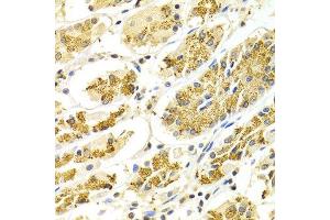 Immunohistochemistry of paraffin-embedded Human gastric using ATP6AP1 antibody at dilution of 1:100 (x400 lens). (ATP6AP1 抗体  (AA 90-390))