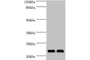 Western blot All lanes: Neuronal calcium sensor 1 antibody at 10 μg/mL Lane 1: Hela whole cell lysate Lane 2: Rat kidney tissue Secondary Goat polyclonal to rabbit IgG at 1/10000 dilution Predicted band size: 22, 20 kDa Observed band size: 22 kDa (NCS1 抗体  (AA 1-190))