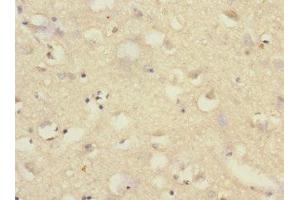 Immunohistochemistry of paraffin-embedded human brain tissue using ABIN7170966 at dilution of 1:100 (SAE1 抗体  (AA 1-346))