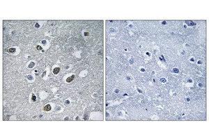 Immunohistochemistry (IHC) image for anti-Membrane-Associated Ring Finger (C3HC4) 4, E3 Ubiquitin Protein Ligase (MARCH4) (C-Term) antibody (ABIN1851269) (MARCH4 抗体  (C-Term))