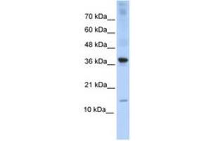 Image no. 1 for anti-Basic Leucine Zipper ATF-like Transcription Factor (BATF) (AA 35-84) antibody (ABIN6740310) (BATF 抗体  (AA 35-84))