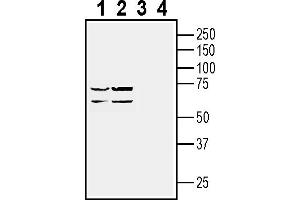 Western blot analysis of human  retinal cell epithelium cell line lysate (lanes 1 and 3) and Malme-3M melanoma cell line lysate (lanes 2 and 4):1-2. (GPR143 抗体  (Intracellular))