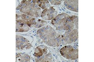 Immunohistochemistry of paraffin-embedded human stomach using APP antibody. (beta Amyloid 抗体)