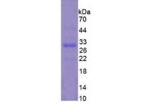 SDS-PAGE analysis of Mouse TNNI3 Protein. (TNNI3 蛋白)