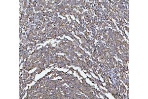 IHC analysis of MIM/MTSS1 using anti-MIM/MTSS1 antibody (ABIN7600276). (MTSS1 抗体  (AA 17-692))