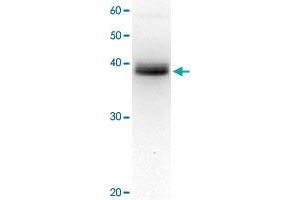Detection of XPA protein in crude extract of HeLa cell by western blotting, using XPA monoclonal antibody, clone 5F12 . (XPA 抗体)