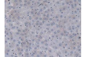 Detection of F2 in Rat Liver Tissue using Monoclonal Antibody to Coagulation Factor II (F2) (Prothrombin 抗体  (AA 201-323))