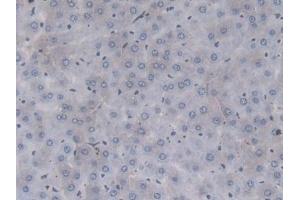 Detection of F2 in Rat Liver Tissue using Monoclonal Antibody to Coagulation Factor II (F2)