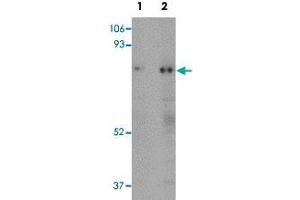 Western blot analysis of human skeletal muscle tissue with RANBP10 polyclonal antibody  at (Lane 1) 1 and (Lane 2) 2 ug/mL dilution. (RANBP10 抗体  (Internal Region))