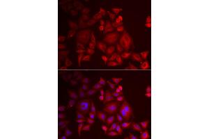 Immunofluorescence analysis of U2OS cell using XCL1 antibody. (XCL1 抗体)